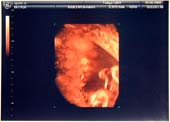 3D-Oct-1-1