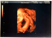 3D-Oct-1-2