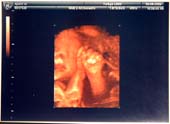 3D-Oct-1-3