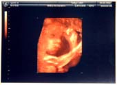 3D-Oct-1-4