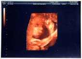 3D-Oct-1-6
